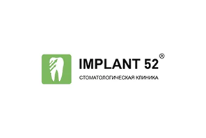 имплант 52